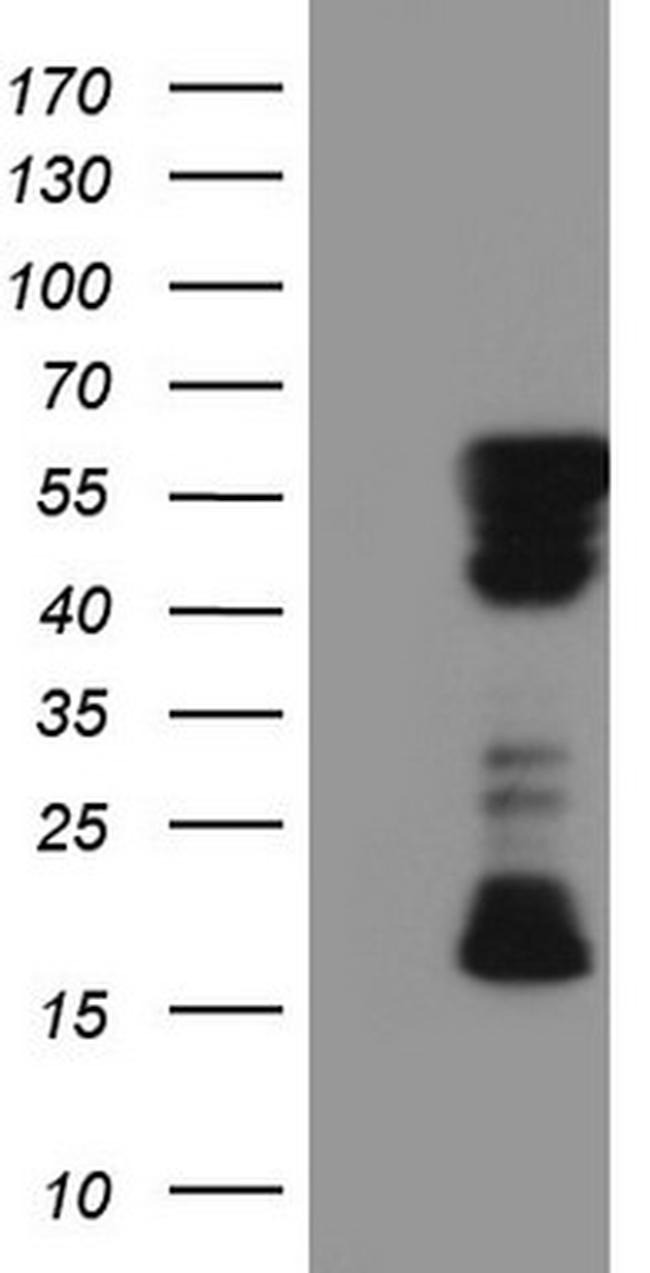 RIPK3 Antibody in Western Blot (WB)