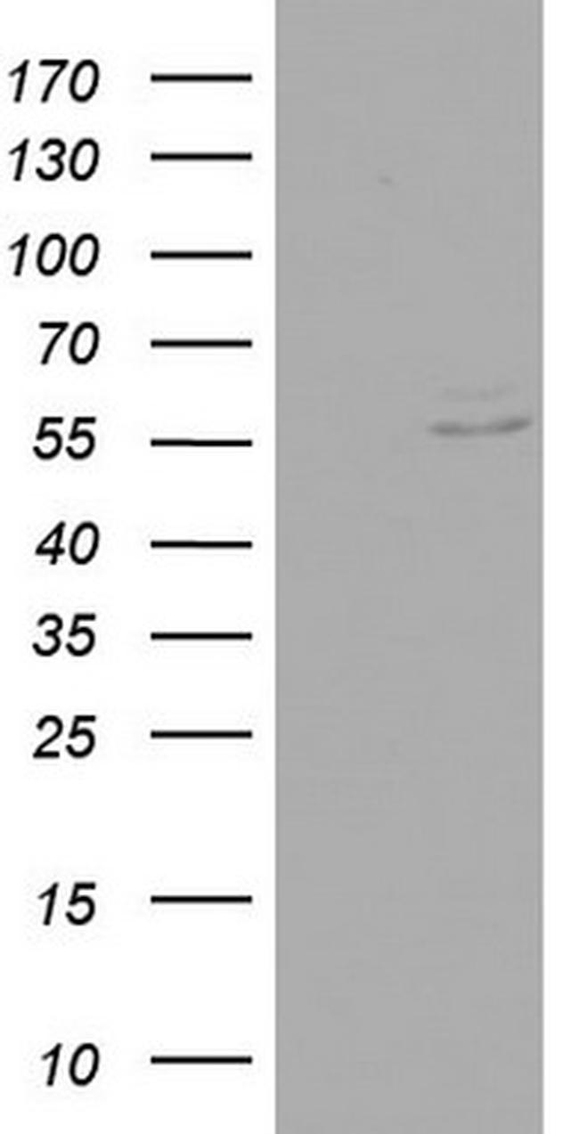 RIPK3 Antibody in Western Blot (WB)