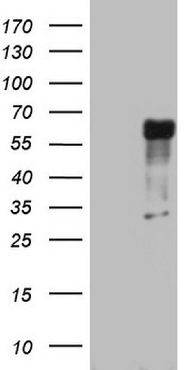 RIPK3 Antibody in Western Blot (WB)