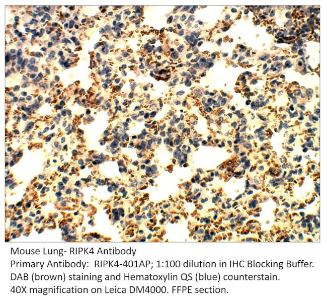 RIPK4 Antibody in Immunohistochemistry (IHC)