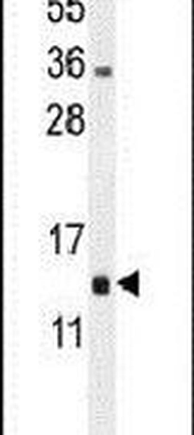 MRPL51 Antibody in Western Blot (WB)