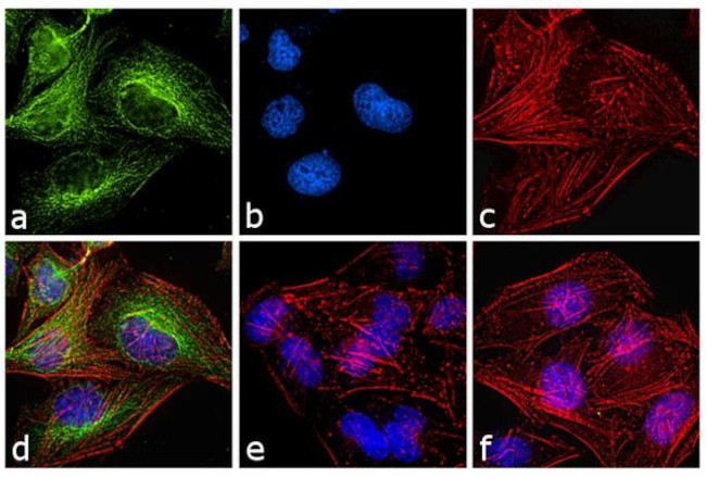 Mouse IgG1 Secondary Antibody in Immunocytochemistry (ICC/IF)
