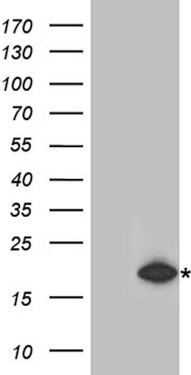RMI2 Antibody in Western Blot (WB)