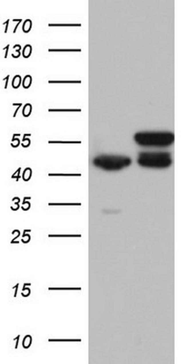 RMND5A Antibody in Western Blot (WB)