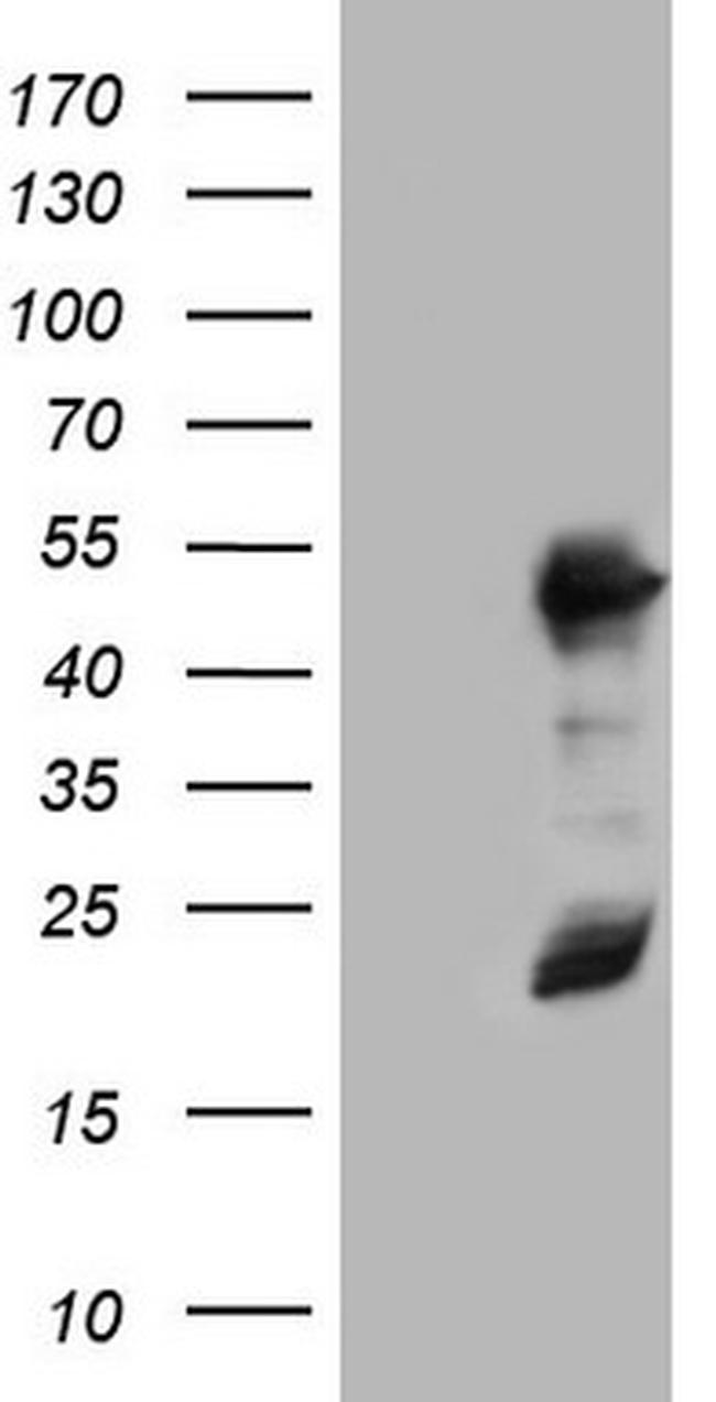 RMND5A Antibody in Western Blot (WB)