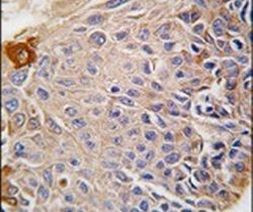 RMND5B Antibody in Immunohistochemistry (IHC)