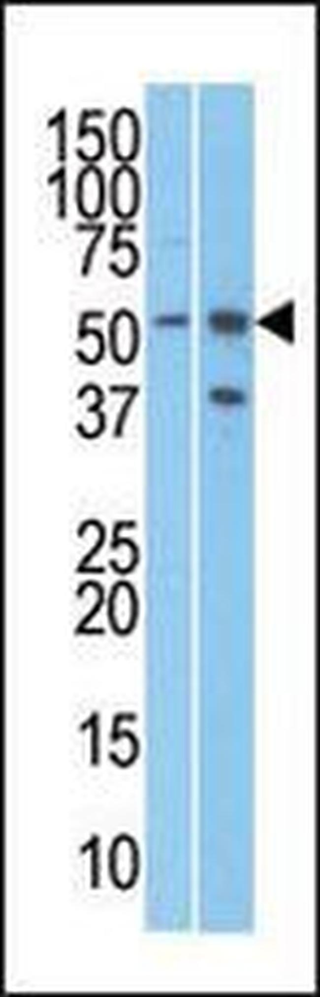 URI1 Antibody in Western Blot (WB)