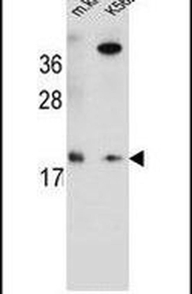 RNF185 Antibody in Western Blot (WB)