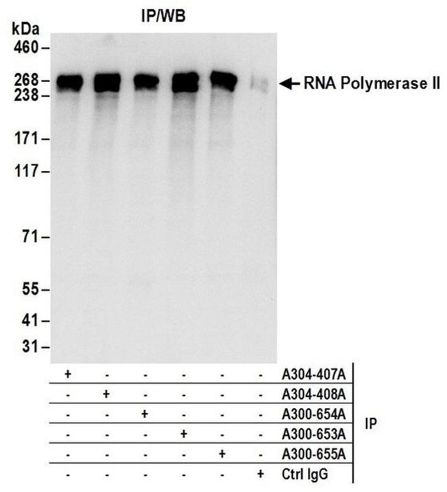Phospho-RNA Polymerase II (Ser2) Polyclonal Antibody (A304-407A)