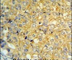 RNaseK Antibody in Immunohistochemistry (IHC)
