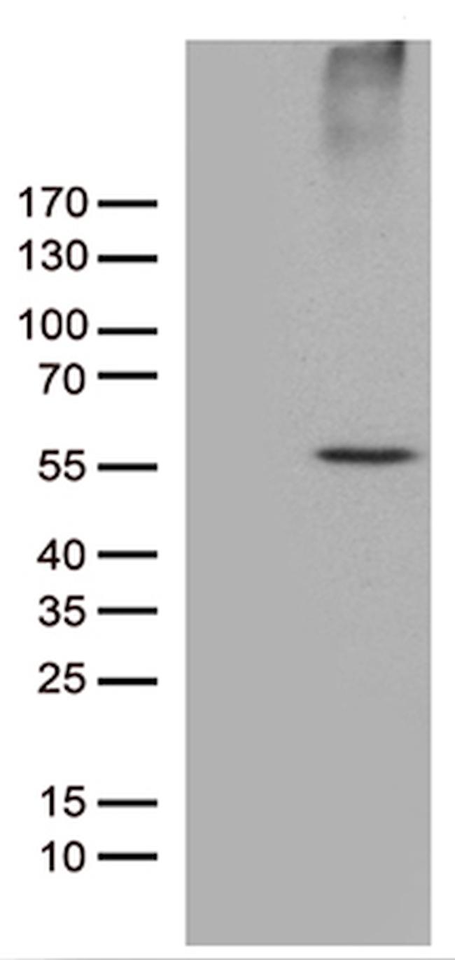 RNF14 Antibody in Western Blot (WB)