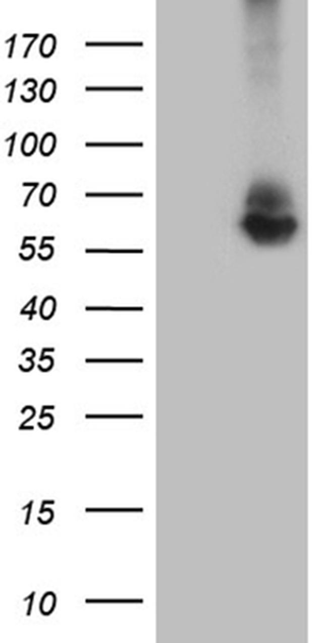 RNF149 Antibody in Western Blot (WB)