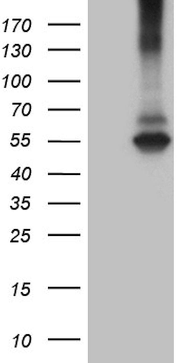 RNF149 Antibody in Western Blot (WB)