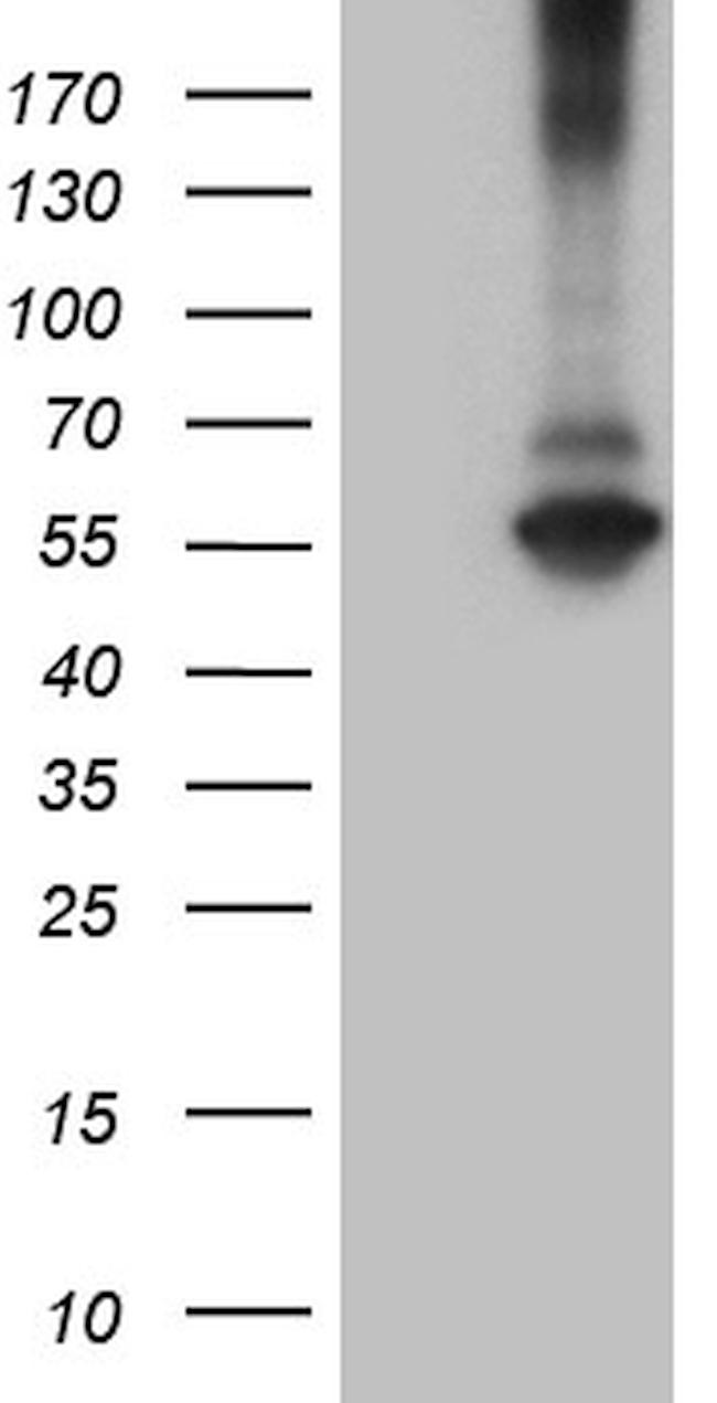 RNF149 Antibody in Western Blot (WB)