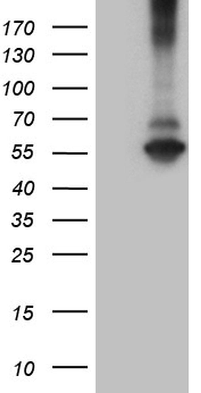RNF149 Antibody in Western Blot (WB)