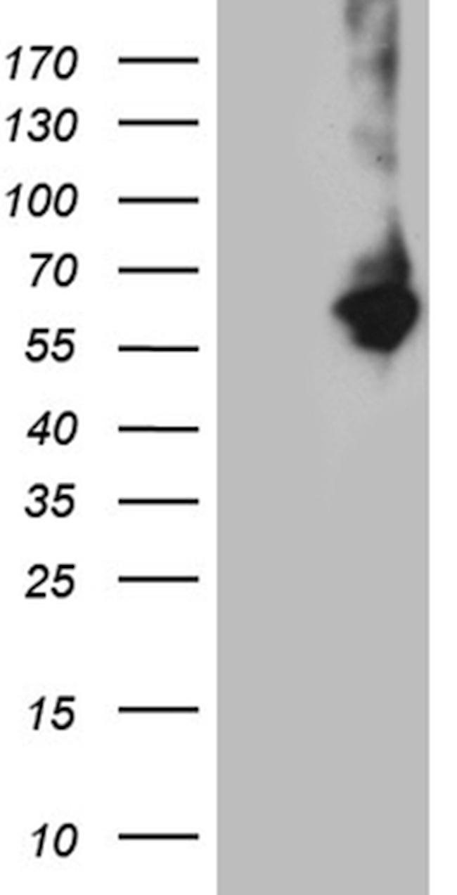 RNF149 Antibody in Western Blot (WB)