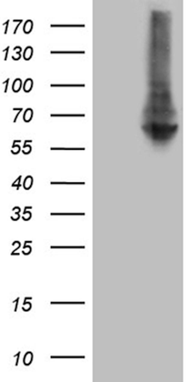 RNF149 Antibody in Western Blot (WB)