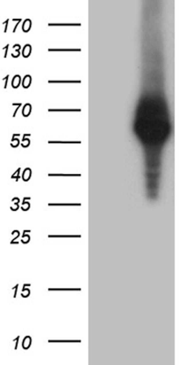 RNF149 Antibody in Western Blot (WB)