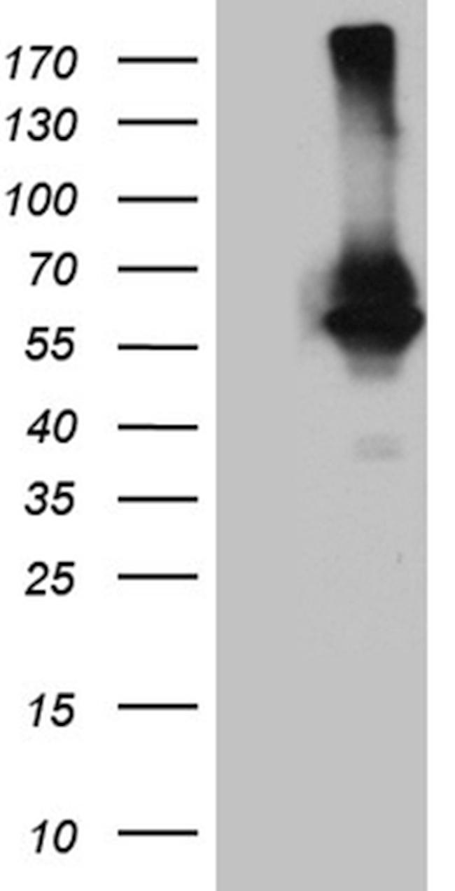 RNF149 Antibody in Western Blot (WB)