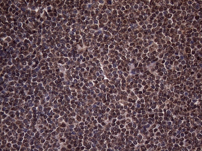 RNF20 Antibody in Immunohistochemistry (Paraffin) (IHC (P))