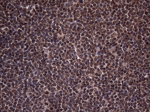 RNF20 Antibody in Immunohistochemistry (Paraffin) (IHC (P))