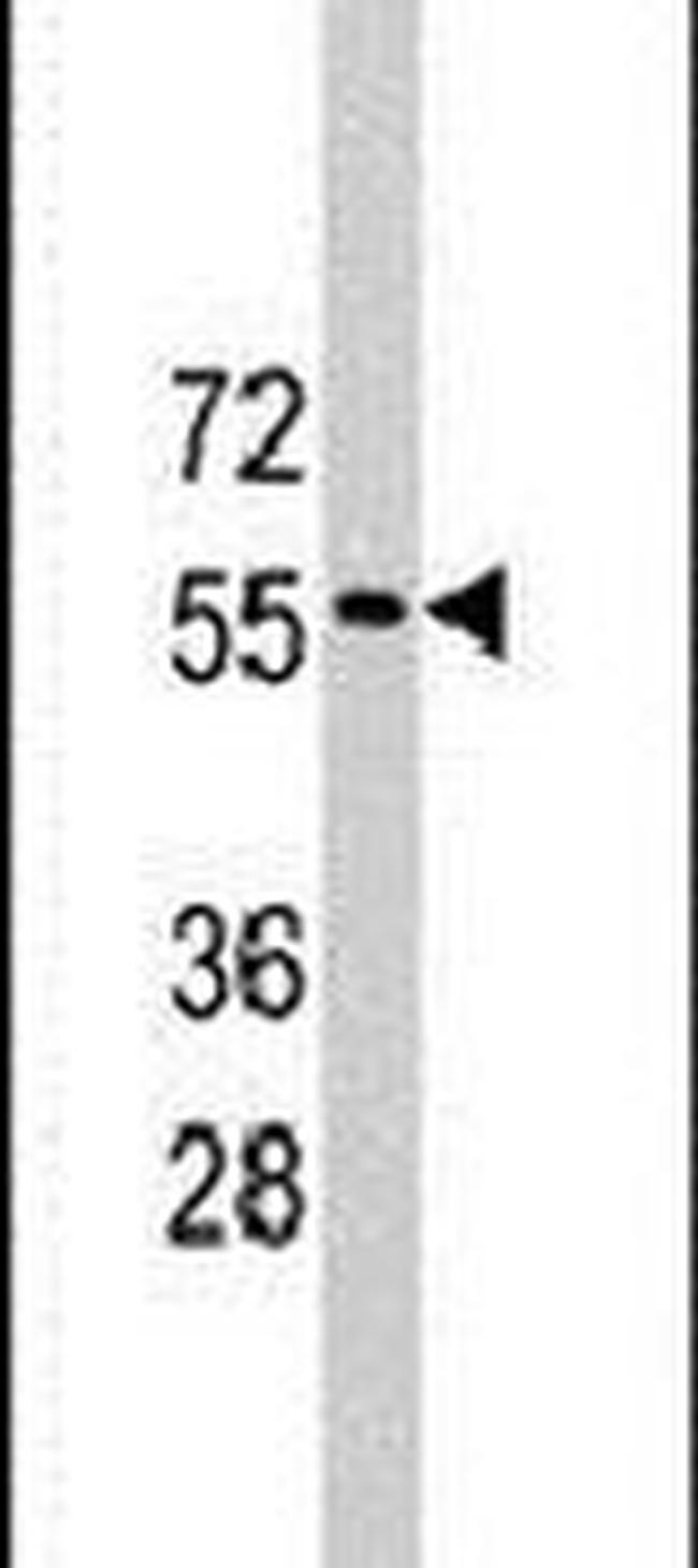 RNF36 Antibody in Western Blot (WB)