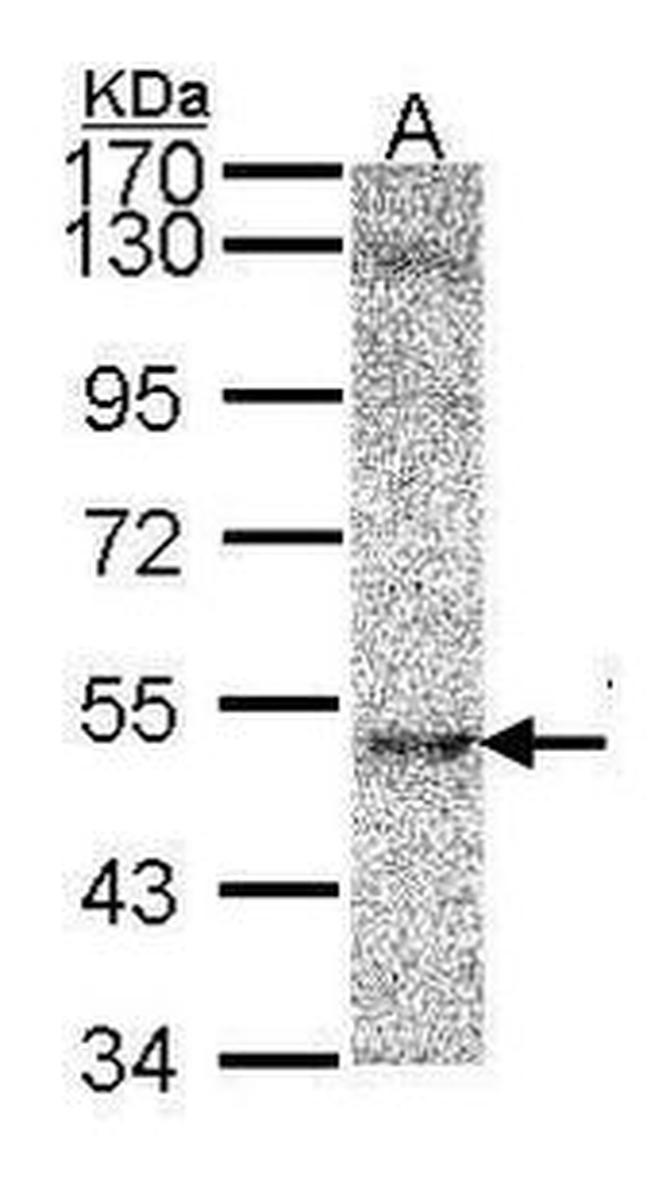 RNF36 Antibody in Western Blot (WB)