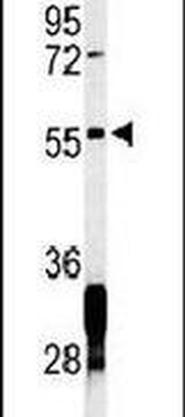 RNF8 Antibody in Western Blot (WB)
