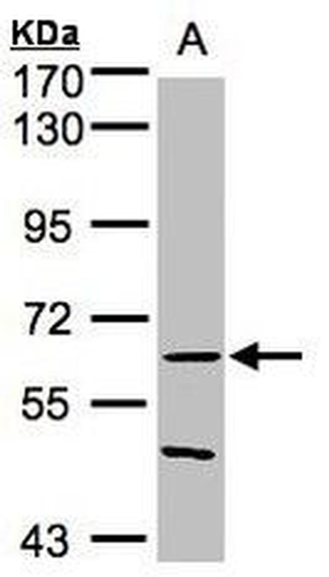 RNF8 Antibody in Western Blot (WB)