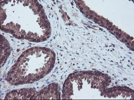 RNH1 Antibody in Immunohistochemistry (Paraffin) (IHC (P))