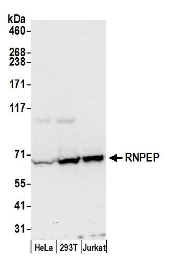 RNPEP Antibody in Western Blot (WB)