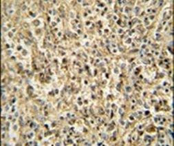 RNASET2 Antibody in Immunohistochemistry (IHC)