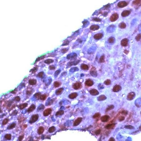 ROC1 Antibody in Immunohistochemistry (IHC)