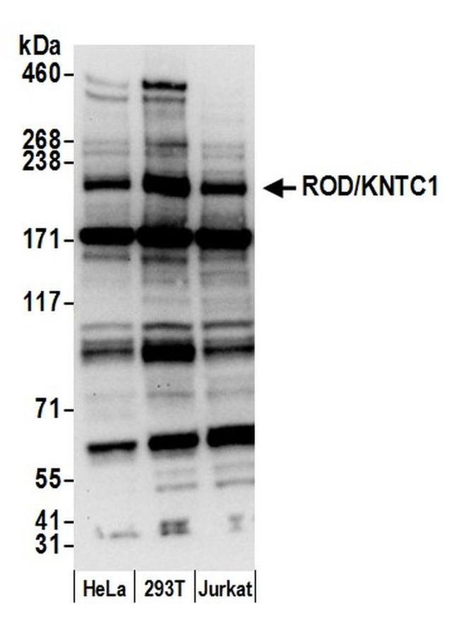 ROD/KNTC1 Antibody in Western Blot (WB)
