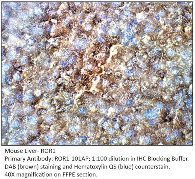 Color Ro1 ROR1 Polyclonal Antibody (ROR1-101AP)