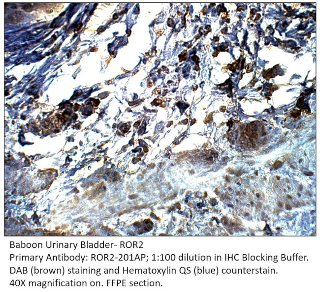 ROR2 Antibody in Immunohistochemistry (IHC)