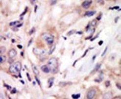ROR2 Antibody in Immunohistochemistry (IHC)