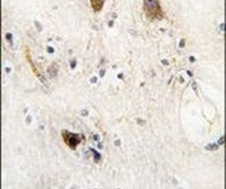 ROR2 Antibody in Immunohistochemistry (IHC)