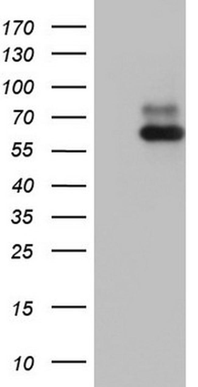 RORA Antibody in Western Blot (WB)