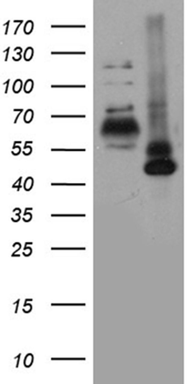 RORA Antibody in Western Blot (WB)