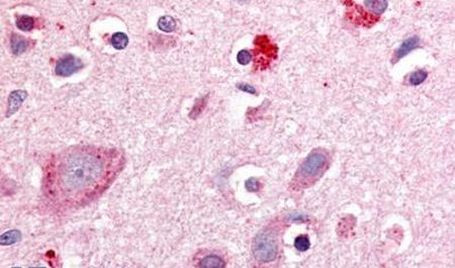 RORB Polyclonal Antibody (PA5-34162)