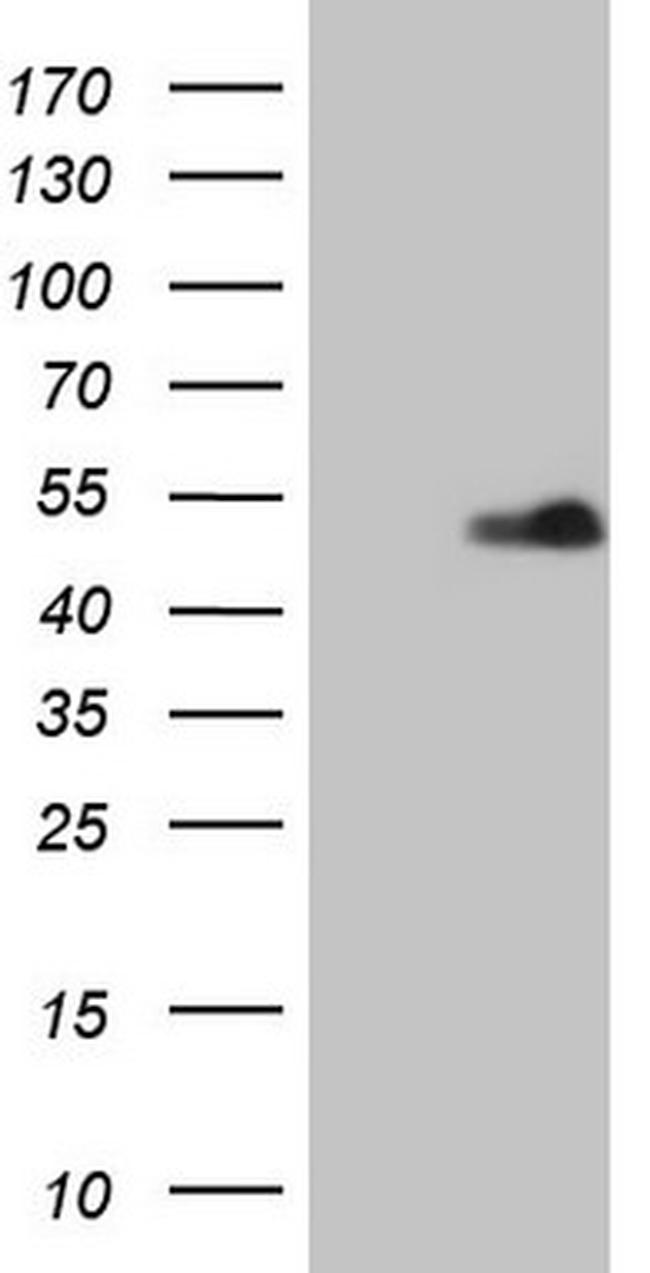 RORB Antibody in Western Blot (WB)