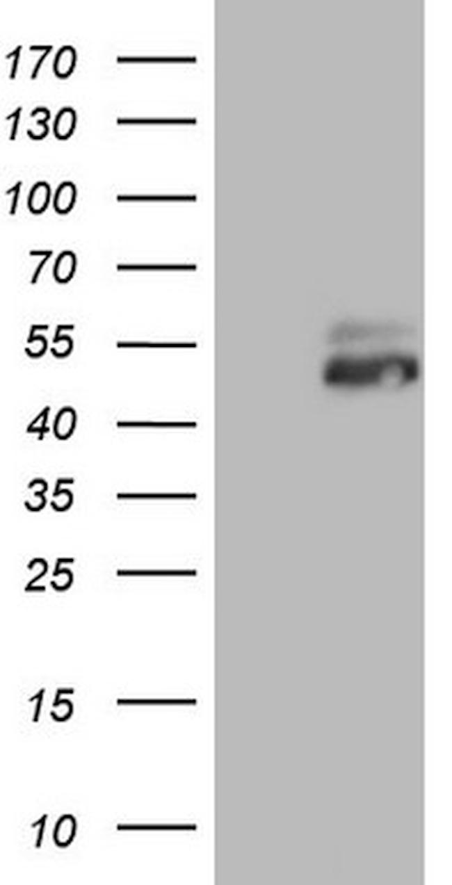 RORB Antibody in Western Blot (WB)