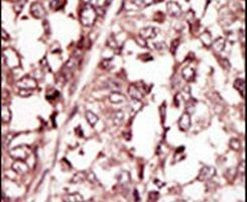 ROS1 Antibody in Immunohistochemistry (IHC)