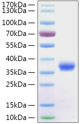 SARS-CoV-2 Spike Protein (RBD) (aa319-541), His Tag Protein
