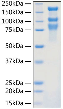 SARS-CoV-2 Spike Protein S1/S2 (aa11-1208), His Tag Protein