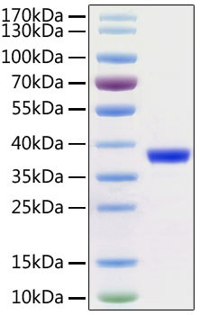 SARS-COV-2 3CL Protease (aa1-306), His and Avi Tag Protein