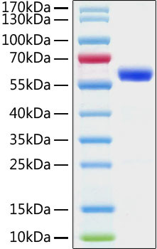 SARS-CoV-2 Spike Protein (RBD) (aa319-541), mFc Tag Protein