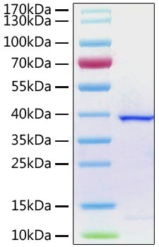 SARS-COV-2 ORF1a Polyprotein (aa1564-1878), His Tag Protein