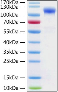 Human ACE2 (aa18-740), His-tag Protein